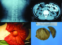 ��ǻ��������������