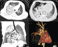 ����ͷ״����1��