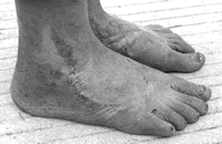 Ƥ��ʪ��Ľ����