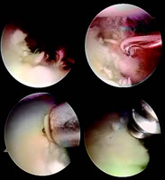 ����ҽԺ�ؽ�������ĸĽ��ؽھ��������Ƽ�ؽ�ϰ������λ