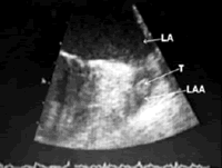 �Ӳ��������Է����������ƺͼ��