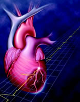 STEMI���ƵĹ�ȥ�����ںͽ���