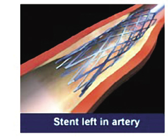 ֧�����������