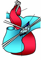 ����-��������ѭ��������PEA�����ٹ�ע��ˮ��