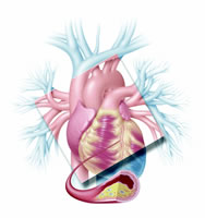 �ӻ������ٴ���������Ӳ���о���������