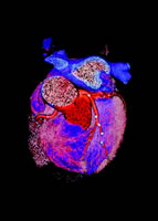 2007��ACCF/AHA CT�����ƻ�����ר�ҹ�ʶ