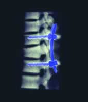 Iso-C ���м�ʱ��ά�����ڼ�����Ƶ�Ӧ��