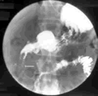 �������ٰ�,��������Щ�ֶ�?