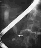 ���ٰ�������Ϻ������о���״