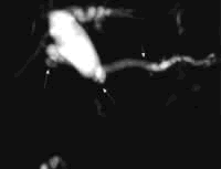 ���ٰ�������Ϻ������о���״