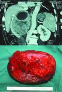 ��ѧ�ƺ����г���Σ�ȸ�ϸ����