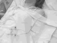 �ζ���������ARDS�����в��ޱ�Ҫ