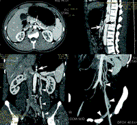 �����������Ҽ�����ϲ���ྫ���ھ�������