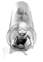 ���IVF�ٴ������� ���⸨��������Ч