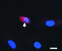 �����ϸ���ɷֻ�Ϊ��ԭ��ϸ�� ��һ���о���̽����δٽ���Щ��ԭ��ϸ�����ѳɾ���