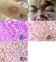 �෢Ƥ���Ĥʹ������鷢��