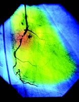 COURAGE�������ܸı�PCIʹ����?