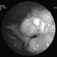 ˫����С�����µĸ��ӽ�������