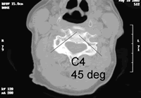 ��׵׵�����ݶ��̶���