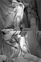 �Է�ת�Ҷ���������ڶ���Զ�̶̹���˿