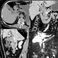 �� ҽѧӰ�� ���ܹ��ٰ�