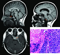 ������ͷʹ�����ӡ���������