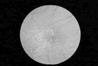 Ӣ��ϣ���ø�ϸ����������ư߱���