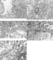 ͨ���罺�ҶԴ���ȱѪ��ϸ����΢�ṹ��������������ܵı�������(һ)