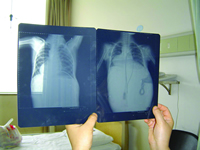 ����12Сʱ�г���ǻ�޴��̥��