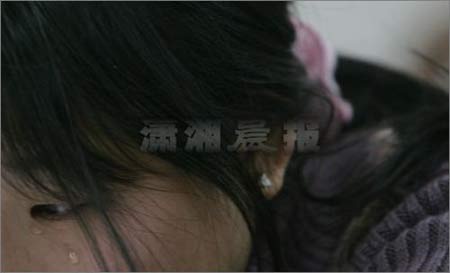 ���̷����״�ֱ��ý�� �ɷ��ڹ����Ծ���(ͼ) 