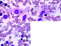 �������ȡ�ƶѪ����ϸ������