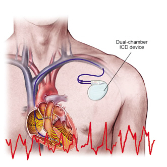 ICD�缫���ߣ������������ߣ�