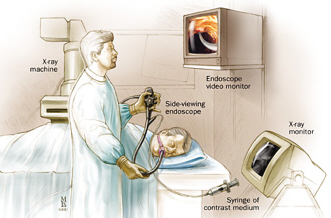 ERCP����Ҫ������׼��