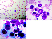 ���ȡ����㡢Ѫ��ϵϸ������