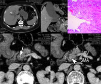 �� ҽѧӰ�� ���������ٵ��ܰ�