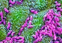 �й������ݸ˾���Ⱦ����θ������ϵ