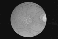 ���ٰ�����:�������벢�Ƕ������