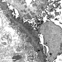 ��Ѫ��ϸ����ֲ��ˮ�ס�����쳣