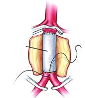 ����������,������������ǻ������?