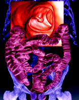 Ⱦɫ�Ŵ�᳦��ɸ���ֱ����Ч������