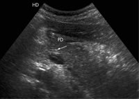 ��ͯ�ϸ�ʹ��������һ��