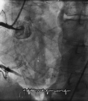 �̷��Թ�״���������Ӻζ�����?