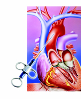 AHA/ACC/ESC��ѧ��������Ĥ�ļ��������Ѫ�ܼ��������е�����(��)