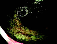 θ������ʳ����֢�������Ĺ�ϵ