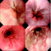 �ھ��·�����ʳ���׷���