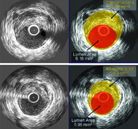 ��������Ӳ�����ƺ͸�Ԥ�о�