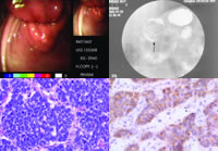 �������ѵ�����������Ѫһ��