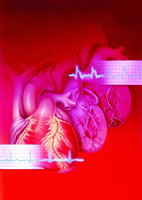 2007 ACC/AHA ST��̧���ļ���������ָ��(���°�)