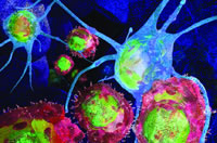 ��ԭ�ʵ�ϸ����GVHD��GVL�е����ν�ɫ?