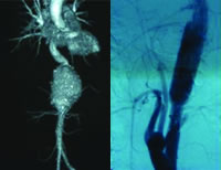 ΢���ӽ���������һ����Σ�ظ���������